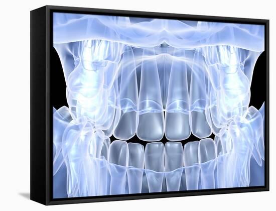 Human Skull with Teeth, Computer Artwork-PASIEKA-Framed Stretched Canvas