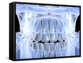 Human Skull with Teeth, Computer Artwork-PASIEKA-Framed Stretched Canvas