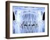 Human Skull with Teeth, Computer Artwork-PASIEKA-Framed Premium Photographic Print