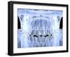 Human Skull with Teeth, Computer Artwork-PASIEKA-Framed Premium Photographic Print