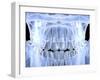 Human Skull with Teeth, Computer Artwork-PASIEKA-Framed Premium Photographic Print