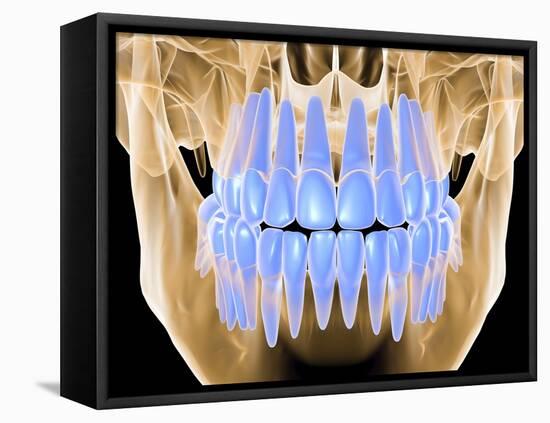 Human Skull with Teeth, Computer Artwork-PASIEKA-Framed Stretched Canvas