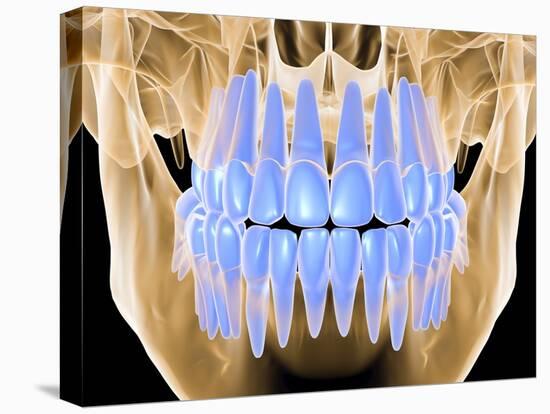 Human Skull with Teeth, Computer Artwork-PASIEKA-Stretched Canvas