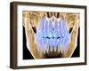 Human Skull with Teeth, Computer Artwork-PASIEKA-Framed Photographic Print