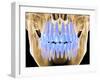 Human Skull with Teeth, Computer Artwork-PASIEKA-Framed Photographic Print