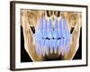 Human Skull with Teeth, Computer Artwork-PASIEKA-Framed Photographic Print