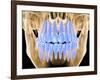 Human Skull with Teeth, Computer Artwork-PASIEKA-Framed Photographic Print