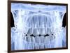 Human Skull with Teeth, Computer Artwork-PASIEKA-Framed Photographic Print