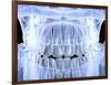 Human Skull with Teeth, Computer Artwork-PASIEKA-Framed Photographic Print