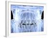 Human Skull with Teeth, Computer Artwork-PASIEKA-Framed Photographic Print