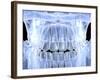 Human Skull with Teeth, Computer Artwork-PASIEKA-Framed Photographic Print