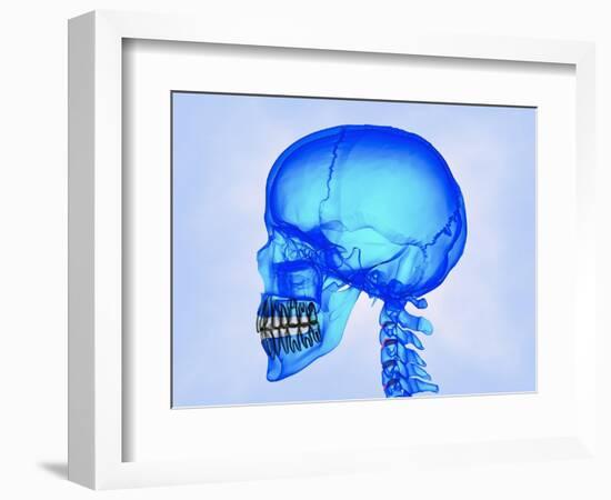 Human Skull-Matthias Kulka-Framed Giclee Print