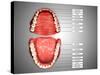 Human Teeth Structure with Labels-null-Stretched Canvas