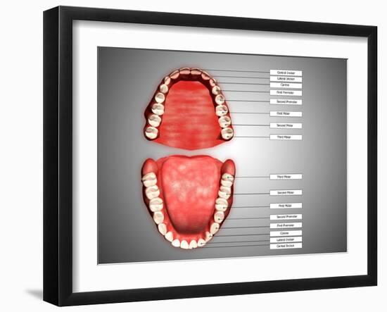 Human Teeth Structure with Labels-null-Framed Art Print