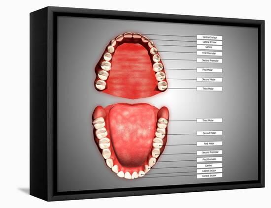 Human Teeth Structure with Labels-null-Framed Stretched Canvas