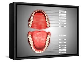 Human Teeth Structure with Labels-null-Framed Stretched Canvas