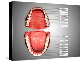 Human Teeth Structure with Labels-null-Stretched Canvas