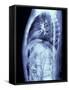 Human Torso, MRI Scan-PASIEKA-Framed Stretched Canvas