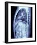 Human Torso, MRI Scan-PASIEKA-Framed Photographic Print