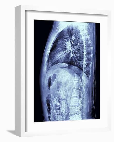 Human Torso, MRI Scan-PASIEKA-Framed Photographic Print