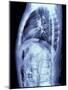 Human Torso, MRI Scan-PASIEKA-Mounted Photographic Print