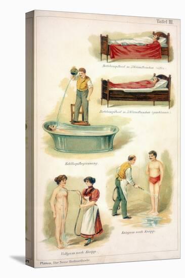 Hydrotherapy Treatments, C1902-null-Stretched Canvas