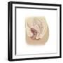 Illustration of a Cystocele Between a Woman's Bladder and Vaginal Wall-null-Framed Premium Giclee Print