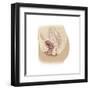 Illustration of a Cystocele Between a Woman's Bladder and Vaginal Wall-null-Framed Art Print