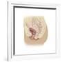 Illustration of a Cystocele Between a Woman's Bladder and Vaginal Wall-null-Framed Art Print