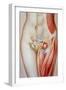 Illustration of a Femoral Hernia-John Bavosi-Framed Photographic Print