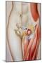 Illustration of a Femoral Hernia-John Bavosi-Mounted Photographic Print