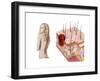 Illustration of an Atypical Growth on the Skin That Could Be a Sign of Skin Cancer-null-Framed Art Print