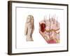 Illustration of an Atypical Growth on the Skin That Could Be a Sign of Skin Cancer-null-Framed Art Print