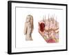 Illustration of an Atypical Growth on the Skin That Could Be a Sign of Skin Cancer-null-Framed Art Print