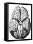 Illustration of Blood Supply To the Brain,C.Wren-Science Photo Library-Framed Stretched Canvas