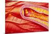 Illustration of Coronary Artery Atherosclerosis-John Bavosi-Mounted Photographic Print