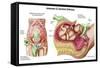 Illustration Showing Caesarean Delivery of Fetus-null-Framed Stretched Canvas