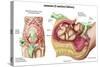 Illustration Showing Caesarean Delivery of Fetus-null-Stretched Canvas