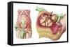 Illustration Showing Caesarean Delivery of Fetus-null-Framed Stretched Canvas