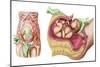 Illustration Showing Caesarean Delivery of Fetus-null-Mounted Art Print