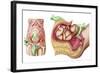 Illustration Showing Caesarean Delivery of Fetus-null-Framed Art Print