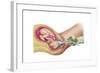 Illustration Showing Delivery of Fetus Using Vacuum Extraction-null-Framed Art Print