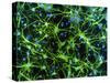 Immunofluorescent LM of Astrocyte Brain Cells-Nancy Kedersha-Stretched Canvas