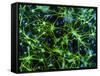 Immunofluorescent LM of Astrocyte Brain Cells-Nancy Kedersha-Framed Stretched Canvas