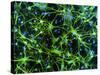 Immunofluorescent LM of Astrocyte Brain Cells-Nancy Kedersha-Stretched Canvas