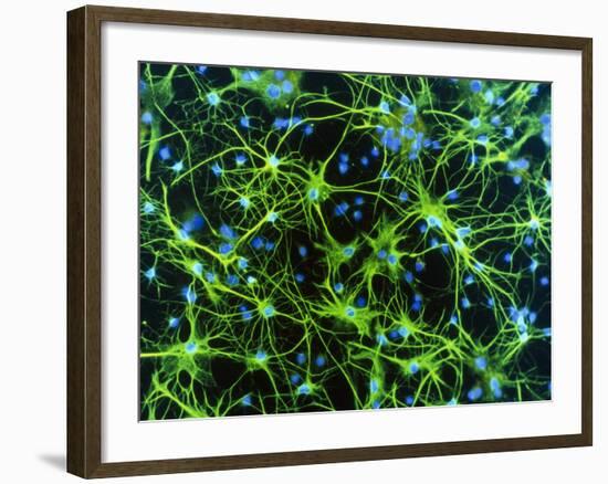 Immunofluorescent LM of Astrocyte Brain Cells-Nancy Kedersha-Framed Photographic Print