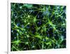 Immunofluorescent LM of Astrocyte Brain Cells-Nancy Kedersha-Framed Photographic Print