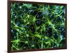 Immunofluorescent LM of Astrocyte Brain Cells-Nancy Kedersha-Framed Photographic Print