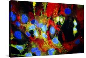 Immunofluorescent LM of HeLa Cells In Culture-Nancy Kedersha-Stretched Canvas