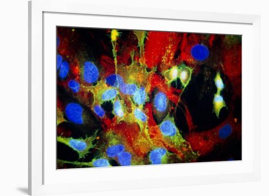 Immunofluorescent LM of HeLa Cells In Culture-Nancy Kedersha-Framed Photographic Print